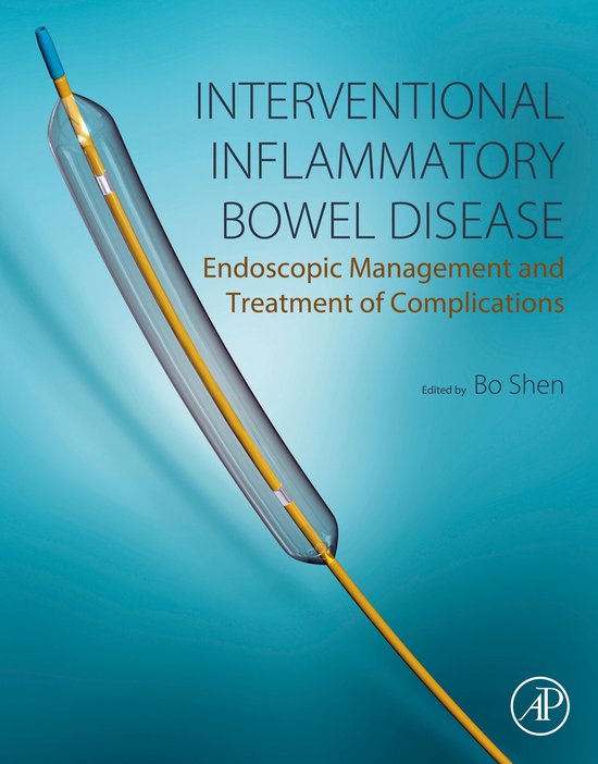 Interventional Inflammatory Bowel Disease: Endoscopic Management and Treatment of ComplicationsEbook