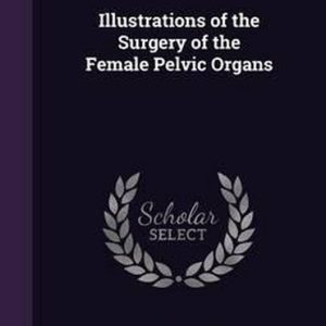 Illustrations of the Surgery of the Female Pelvic Organs Illustrations of the Surgery of the Female Pelvic Organs