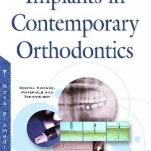 Implants in Contemporary Orthodontics Implants in Contemporary Orthodontics