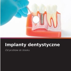 Implanty dentystyczne Od podstaw do blasku Implanty dentystyczne Od podstaw do blasku