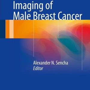 Imaging of Male Breast CancerEbook Imaging of Male Breast CancerEbook