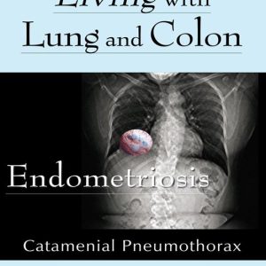 Living With Lung and Colon EndometriosisEbook Catamenial Pneumothorax Living With Lung and Colon EndometriosisEbook Catamenial Pneumothorax
