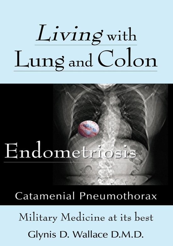 Living With Lung and Colon EndometriosisEbook Catamenial Pneumothorax